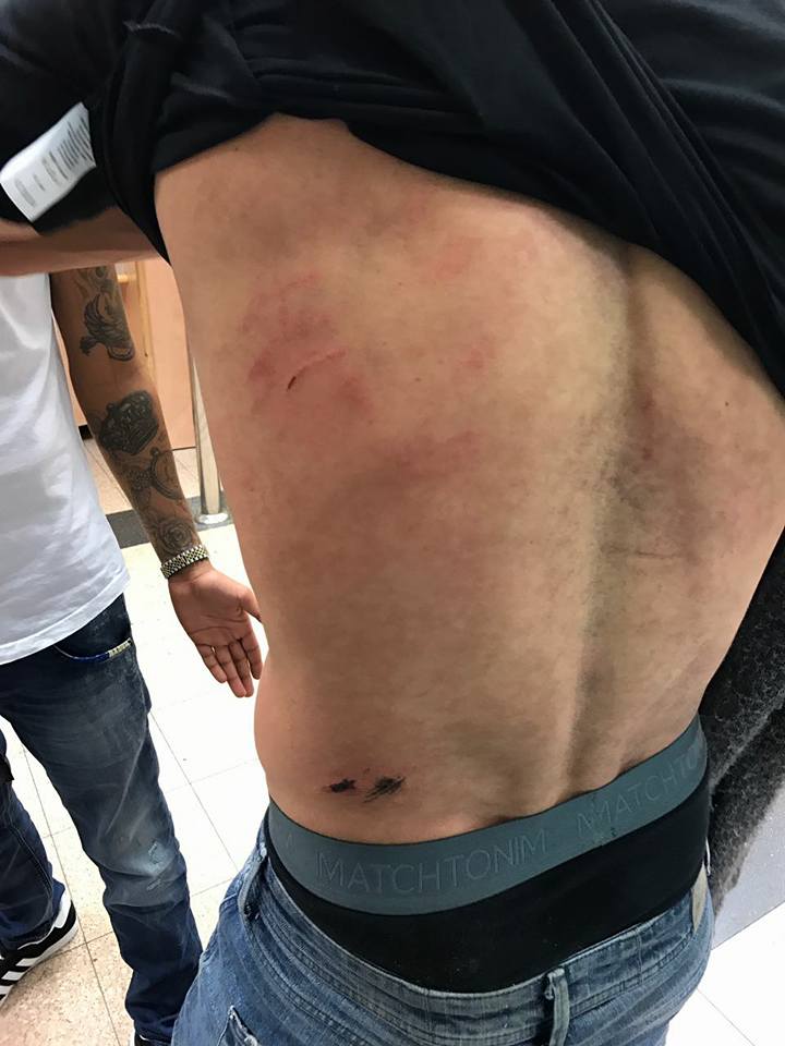 הפציעה של בוכריס (תיעוד - מתוך הפייסבוק האישי)